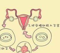 三代试管婴儿移植前可以吃东西吗？